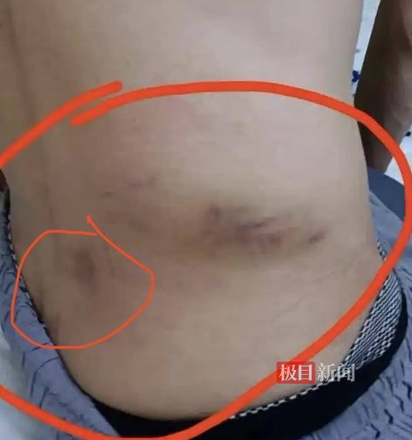 高危体育项目安全标准深度解析:景区蹦极事故背后的技术漏洞与责任边界 新闻 高危体育项目安全标准深度解析:景区蹦极事故背后的技术漏洞与责任边界 新闻 高危体育项目安全标准深度解析:景区蹦极事故背后的技术漏洞与责任边界 新闻 高危体育项目安全标准深度解析:景区蹦极事故背后的技术漏洞与责任边界 新闻